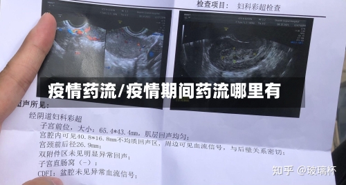 疫情药流/疫情期间药流哪里有-第3张图片
