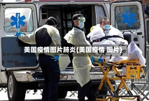 美国疫情图片肺炎(美国疫情 图片)