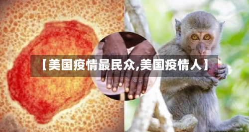 【美国疫情最民众,美国疫情人】-第2张图片