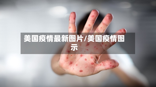 美国疫情最新图片/美国疫情图示-第2张图片