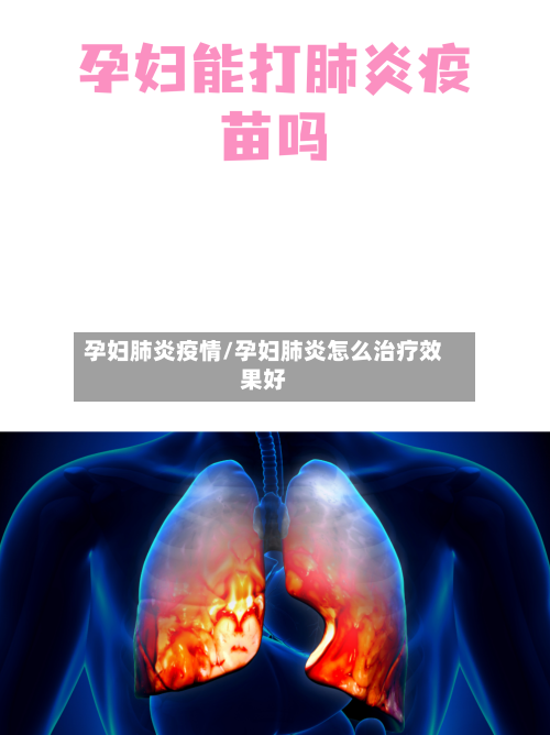 孕妇肺炎疫情/孕妇肺炎怎么治疗效果好-第3张图片