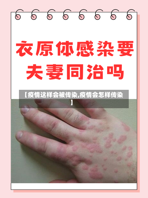 【疫情这样会被传染,疫情会怎样传染】